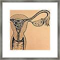 Artwork Of An Intrauterine Device In The Uterus Framed Print