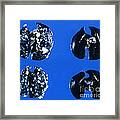 Cancer In Mouse Lungs Framed Print