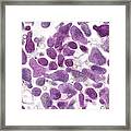 Mycoplasma Genitalium Bacteria Framed Print