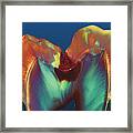 Polarised Lm Of A Molar Tooth Showing Decay Framed Print