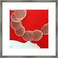 Streptococcus Mutans Bacteria On Tooth Framed Print
