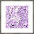 Calcium Concretions In Human Pineal Gland #2 Framed Print