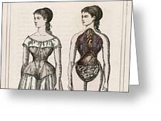 What A Corset Does For, And To A Girl Poster by Mary Evans Picture Library  - Pixels