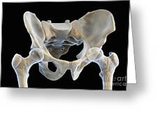 Hip Bones Male #16 Photograph by Science Picture Co - Fine Art America