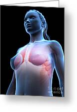 Breast Implants #17 Art Print by Sebastian Kaulitzki/science Photo Library  - Fine Art America