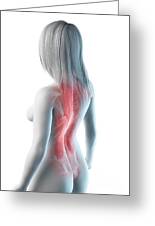 Female back muscles, illustration - Stock Image - C052/4269 - Science Photo  Library