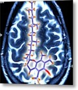 Brain Mri Scan And Vitamin E Molecule #1 Metal Print