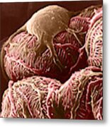 Kidney Glomerulus, Sem #1 Metal Print