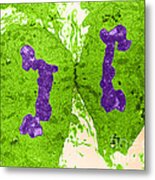 Mitosis, Late Telophase, Tem #1 Metal Print