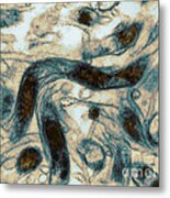 Borrelia Burgdorferi Lyme Disease Tem #3 Metal Print