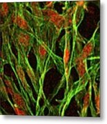 Brain Protein In Cancer Research #2 Metal Print