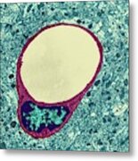 Capillary And Endothelial Cell #2 Metal Print