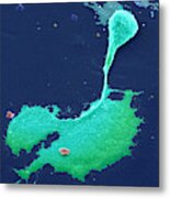 Nerve Cell With Axon And Growth Cone #2 Metal Print