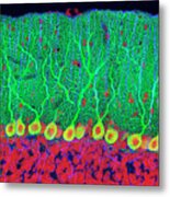 Purkinje Nerve Cells In The Cerebellum Metal Print