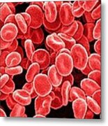Red Blood Cells, Sem #3 Metal Print