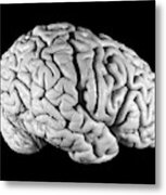 Einstein's Brain #4 Metal Print