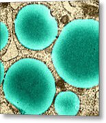 Lipid Droplets, Tem #4 Metal Print