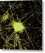 Nerve Cells Light Micrograph #4 Metal Print