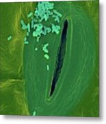 Spinach Infected With E. Coli #4 Metal Print