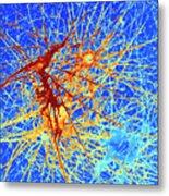 Nerve Cells #5 Metal Print