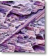 Uric Acid Crystals #5 Metal Print