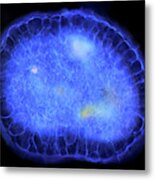 Actinosphaerium Protozoan #7 Metal Print