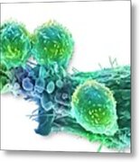 Cancer Cell And T Lymphocytes #7 Metal Print