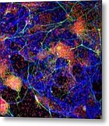 Stem Cell-derived Nerve Cells #7 Metal Print