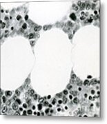 Bone Marrow & Fat Cells, Lm Metal Print