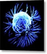 Breast Cancer Cell Metal Print