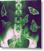 Butterflies In The Stomach Metal Print