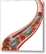 Circulatory System, Illustration Metal Print
