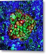 Colorectal Cancer Cells Metal Print