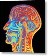 Coloured Mri Scan Of The Human Head (side View) Metal Print