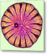 Diatom, Cyclotella Meneghiniana Metal Print