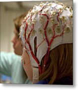 Girl Connected With Cables For Eeg For A Scientific Experiment Metal Print