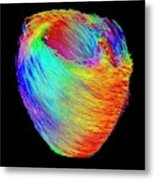 Heart Muscle Fibres Metal Print