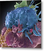 Hiv-infected And Normal T Cells Metal Print