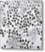 Hiv Virus Metal Print