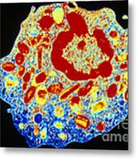 Human Eosinophil Metal Print