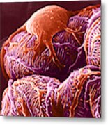 Kidney Glomerulus, Sem Metal Print