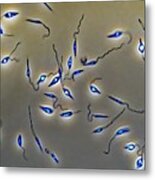 Leishmania Parasites Metal Print