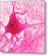 Motor Neuron In An Ox Spinal Cord. Lm Metal Print