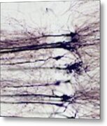 Nerve Cells Metal Print