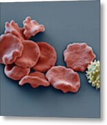 Red Blood Cells And Lymphocyte, Sem Metal Print