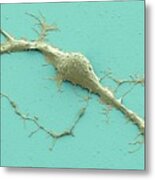 Stem Cell-derived Neuron Metal Print