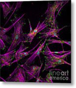 Sticky Stem Cells Fm Metal Print