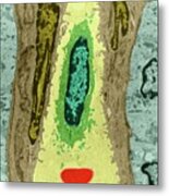 White Blood Cell In Capillary Metal Print