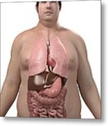 Obese Man's Organs, Artwork #1 Metal Print