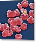 Red Blood Cells, Sem #1 Metal Print